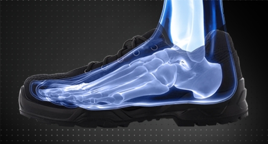 Обувь для профилактики плоскостопия: какую выбрать?